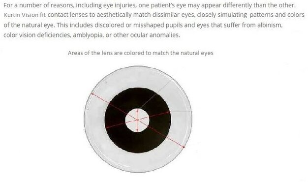 Prosthetic lenses for corneal injury or scarring