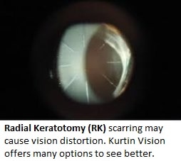 Radial Keratotomy Picture